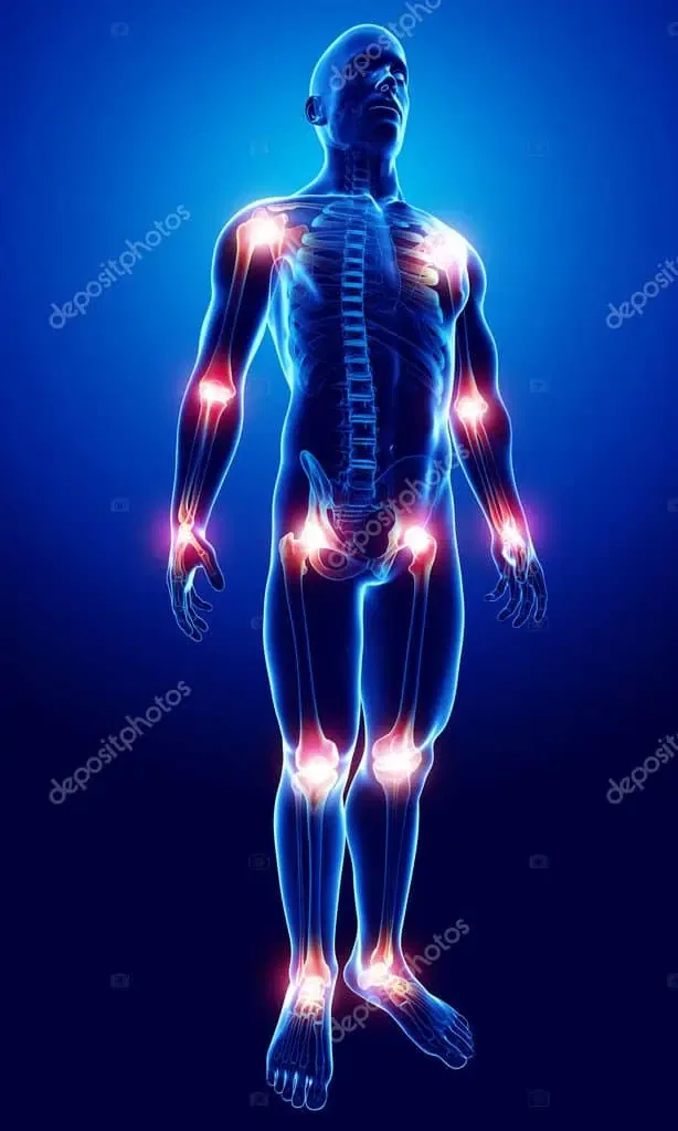 Depositphotos 22675667 Stock Photo Joint Pain Antomy